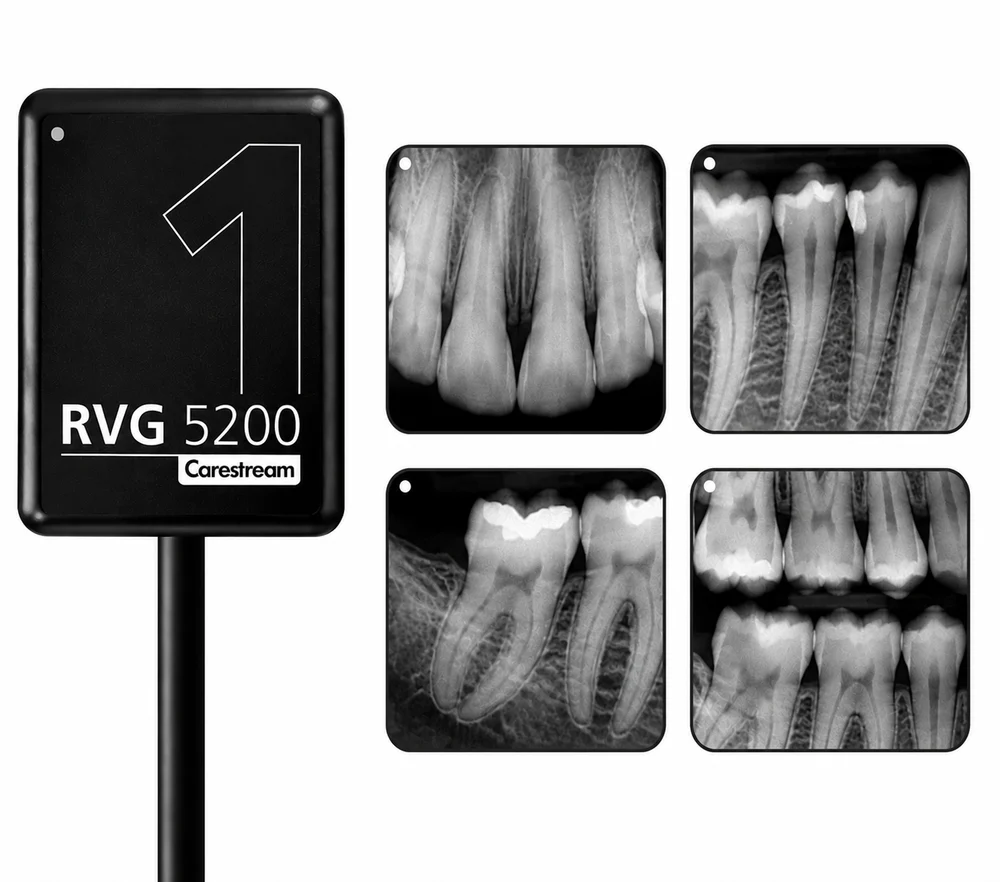 RVG Sensor